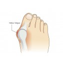 Achat pour soulager Hallux valgus